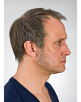 Sideburn