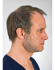 Sideburn