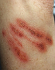 Varias heridas 2 - Heridas aleatorias 2