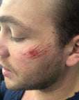 Varias heridas 1 - Heridas aleatorias 1