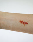 Cicatrices y Suturas B- Cicatrices y Suturas B